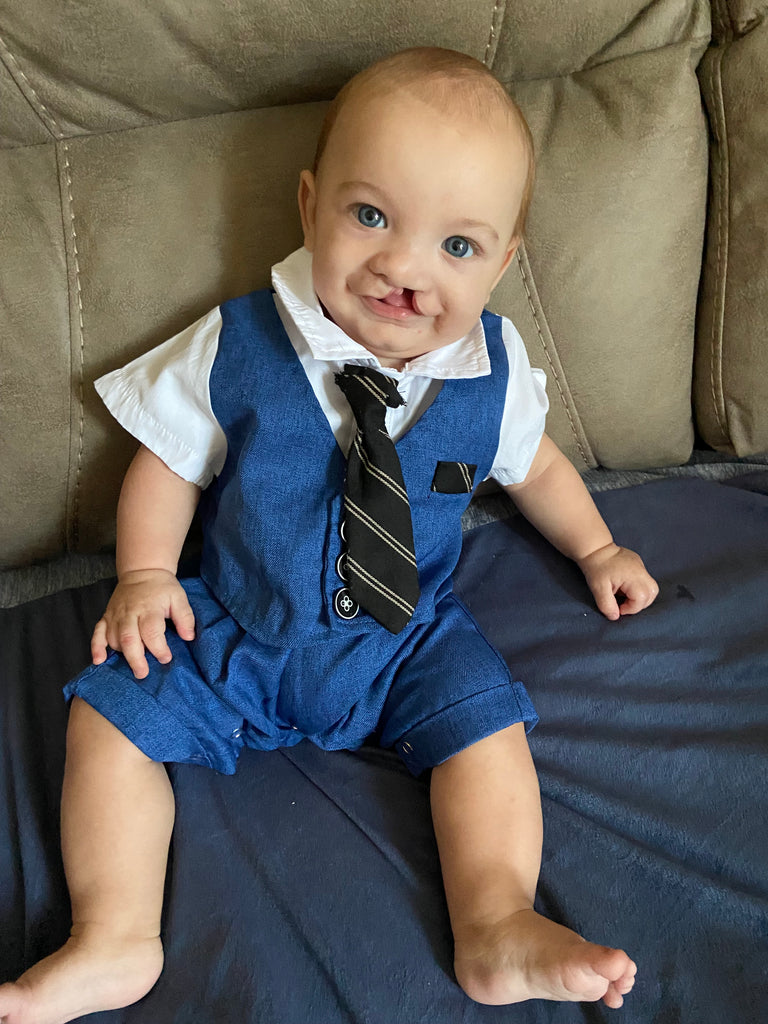 Sponsor A Brave Gown For Five-Month-Old Preston Undergoing Surgery