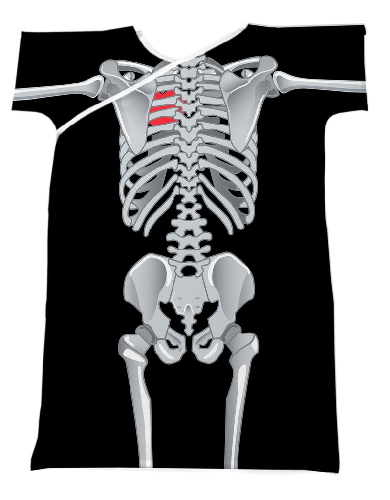 NO BONES ABOUT IT